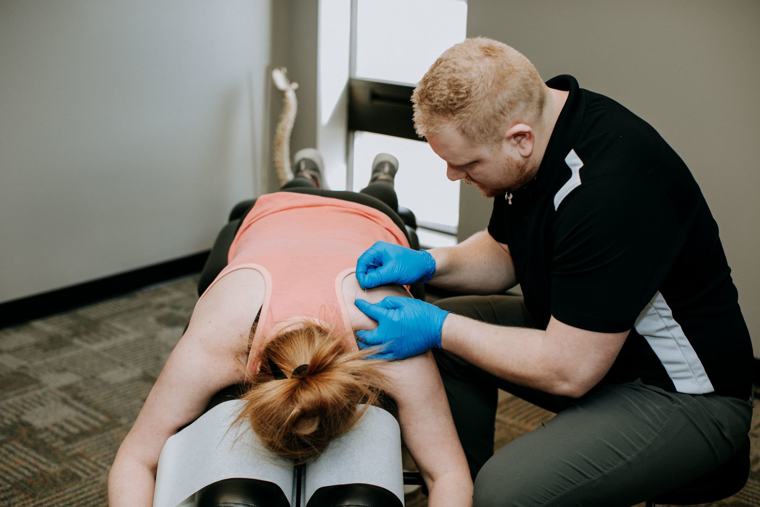 Dry Needling at Elite Kearney