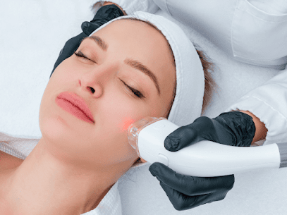 how much is laser therapy to get rid of stretch marks