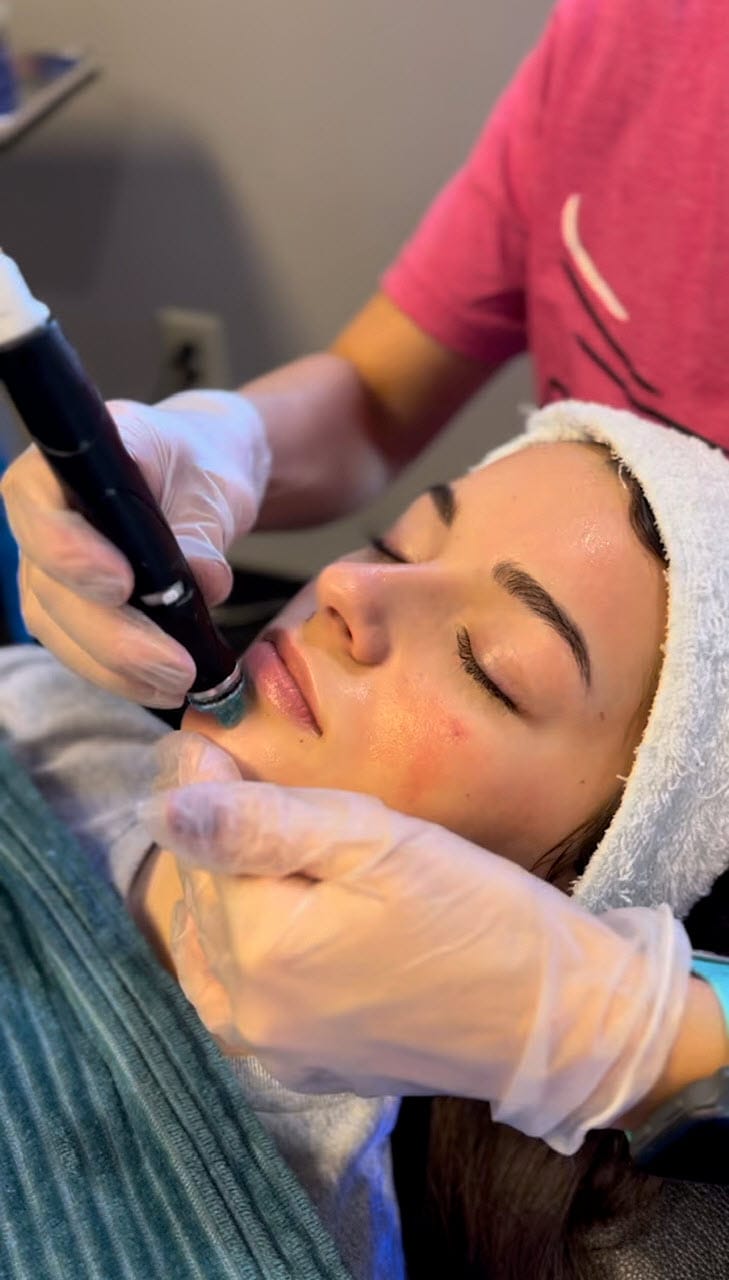 Patient being treated with HydraFacial